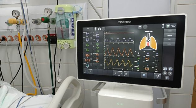 equipamento de ventilação pulmonar do HUSE 17 DE JULHO 25